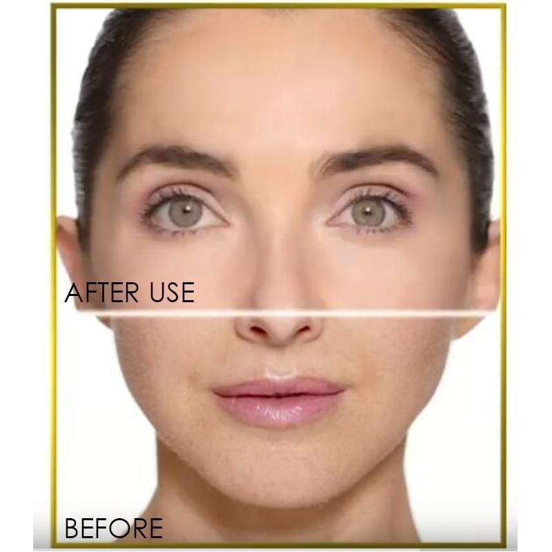 Dermaplane Exfoliator + Hair Remover Incl. 6 Replacement Blades_3